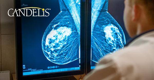 Candelis Lauded by Frost & Sullivan for Accelerating Accurate Diagnosis with Its Multi-Modal Breast Imaging Solution, Advanced Breast Imaging Enterprise Viewer