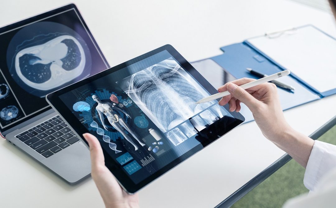 Global Medical Imaging Informatics Market Accelerated by Cloud and AI to Enable Deployment Options and Support Decision-making